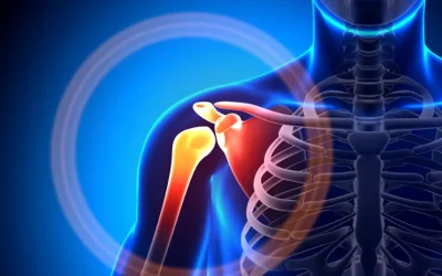 Most Common Causes of Shoulder Pain in Lifters